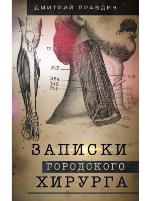 Записки городского хирурга